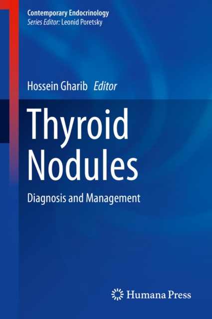 Thyroid Nodules : Diagnosis and Management, EPUB eBook