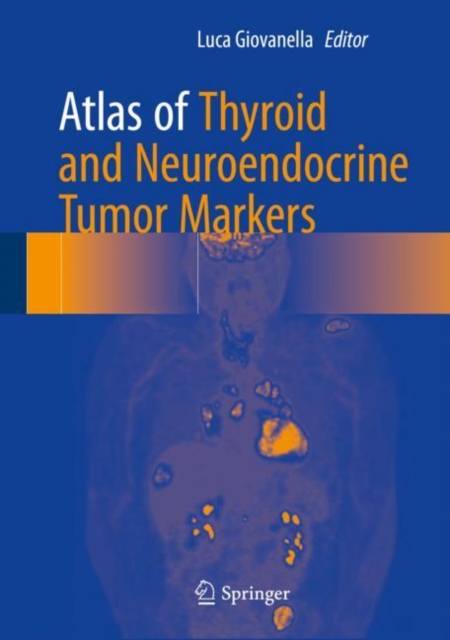 Atlas of Thyroid and Neuroendocrine Tumor Markers, Hardback Book