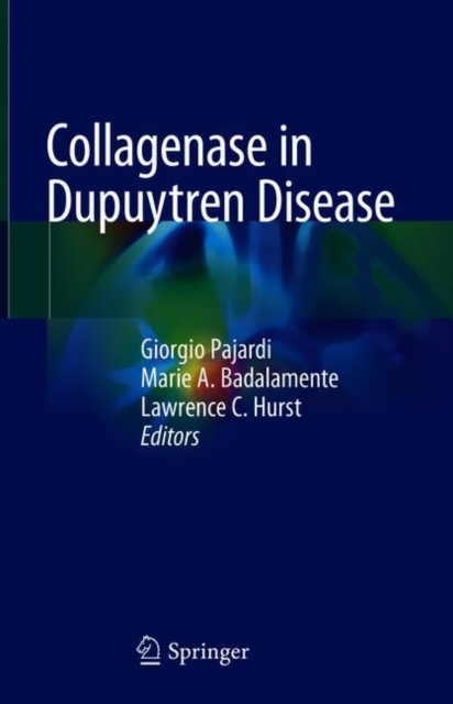 Collagenase in Dupuytren Disease, EPUB eBook
