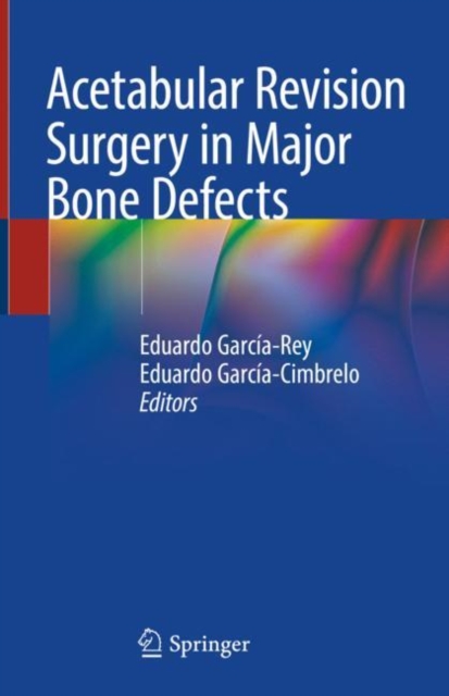 Acetabular Revision Surgery in Major Bone Defects, EPUB eBook