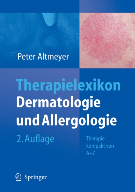 Therapielexikon Dermatologie und Allergologie : Therapie kompakt von A-Z, PDF eBook