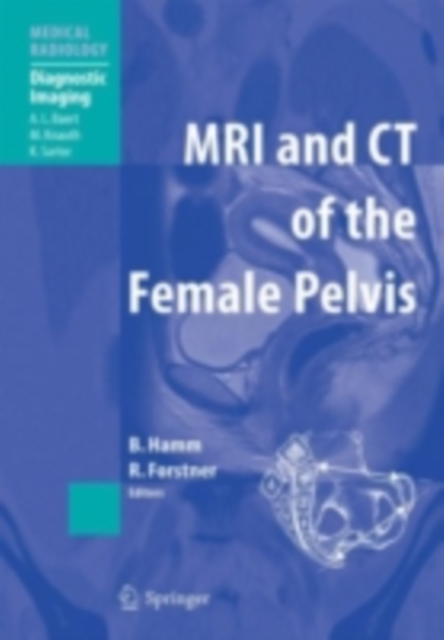 MRI and CT of the Female Pelvis, PDF eBook