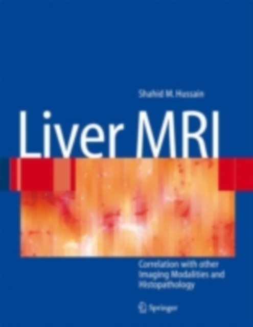Liver MRI : Correlation with other Imaging Modalities and Histopathology, PDF eBook