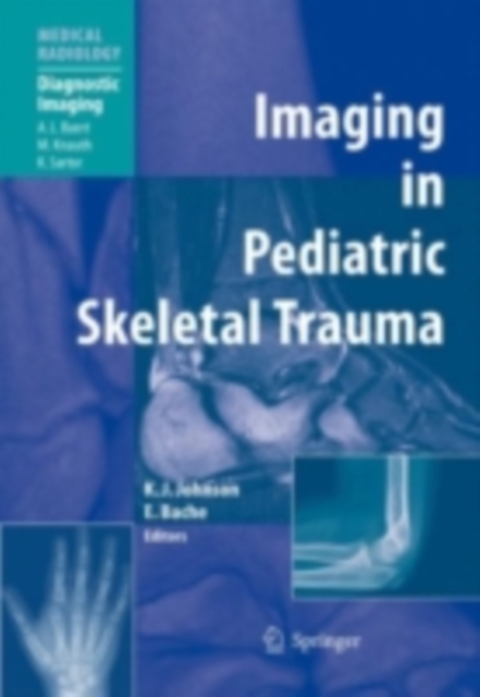 Imaging in Pediatric Skeletal Trauma : Techniques and Applications, PDF eBook