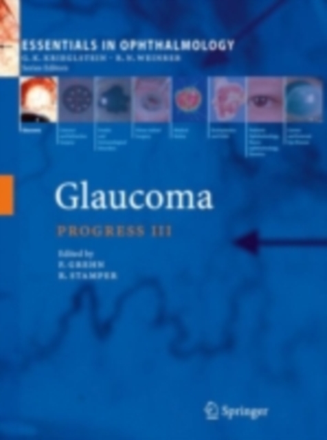 Glaucoma, PDF eBook