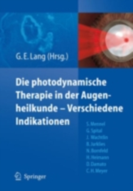 Die photodynamische Therapie in der Augenheilkunde - Verschiedene Indikationen, PDF eBook