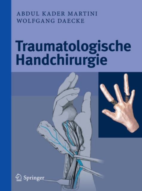 Traumatologische Handchirurgie, PDF eBook