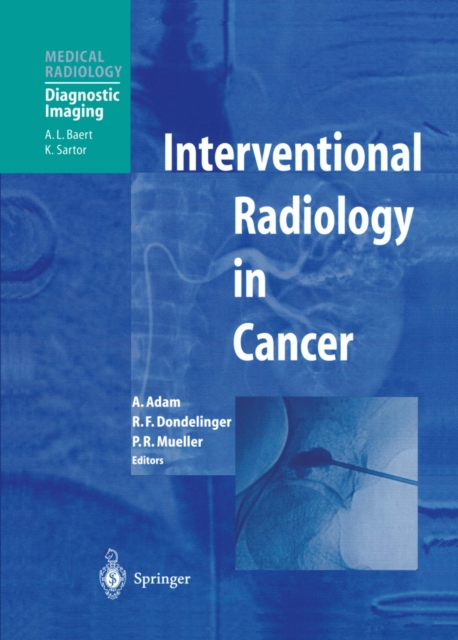 Interventional Radiology in Cancer, PDF eBook