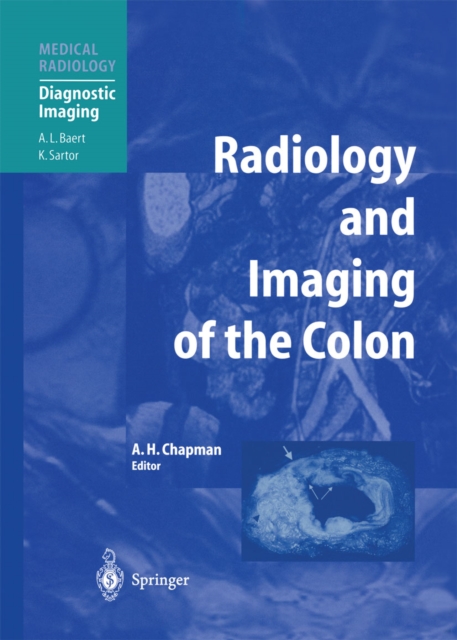 Radiology and Imaging of the Colon, PDF eBook