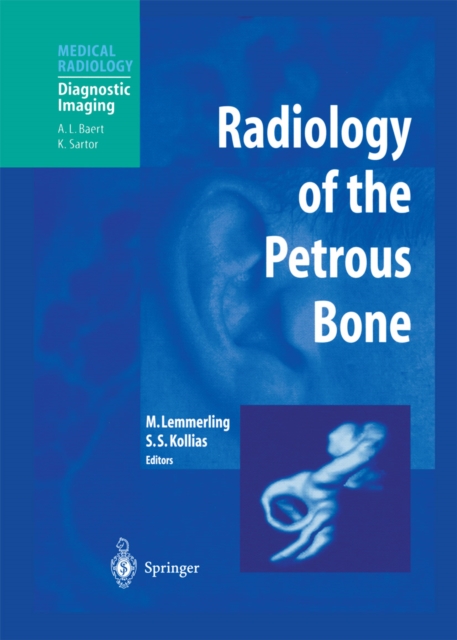Radiology of the Petrous Bone, PDF eBook
