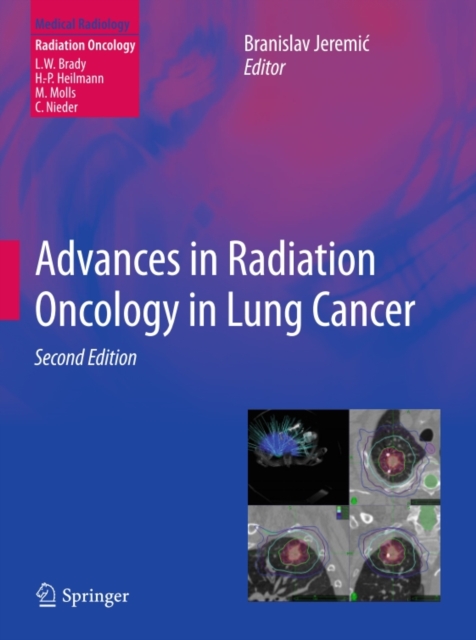 Advances in Radiation Oncology in Lung Cancer, PDF eBook
