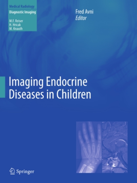 Imaging Endocrine Diseases in Children, PDF eBook