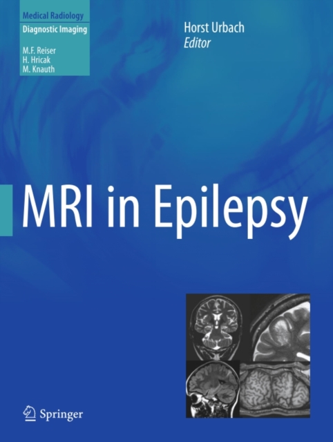 MRI in Epilepsy, PDF eBook
