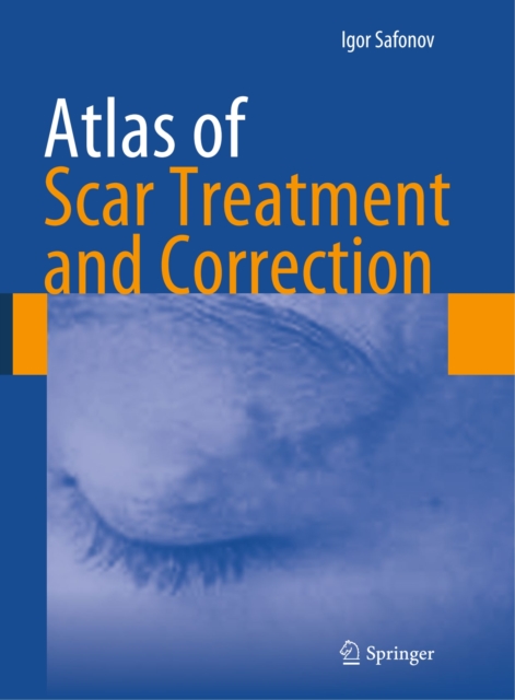 Atlas of Scar Treatment and Correction, PDF eBook