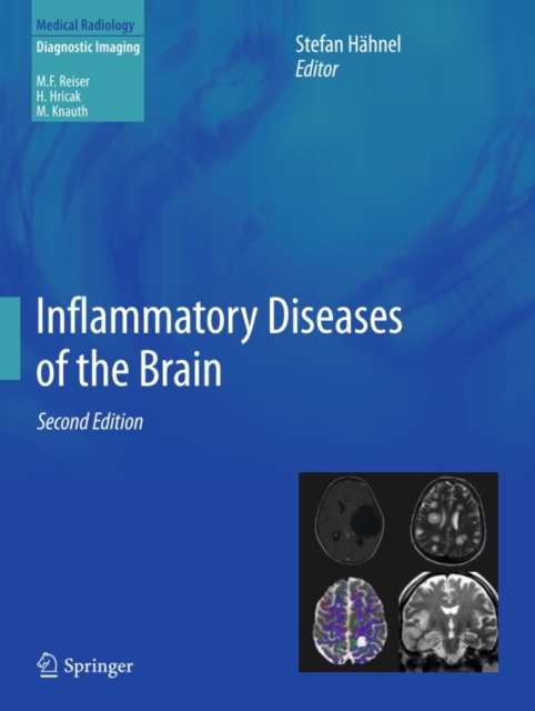 Inflammatory Diseases of the Brain, PDF eBook