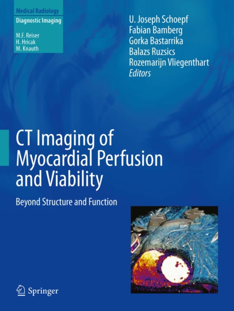 CT Imaging of Myocardial Perfusion and Viability : Beyond Structure and Function, PDF eBook