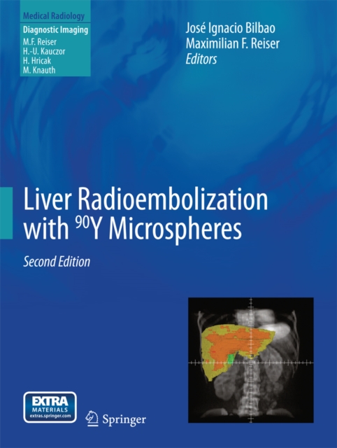 Liver Radioembolization with 90Y Microspheres, PDF eBook
