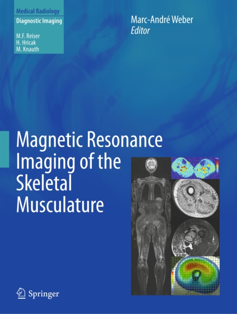 Magnetic Resonance Imaging of the Skeletal Musculature, PDF eBook