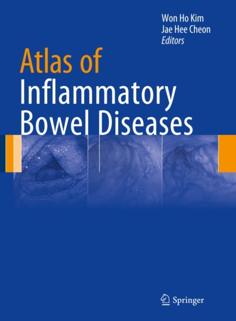 Atlas of Inflammatory Bowel Diseases, PDF eBook