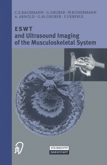 ESWT and Ultrasound Imaging of the Musculoskeletal System, PDF eBook