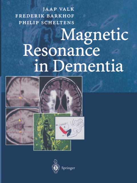 Magnetic Resonance in Dementia, PDF eBook