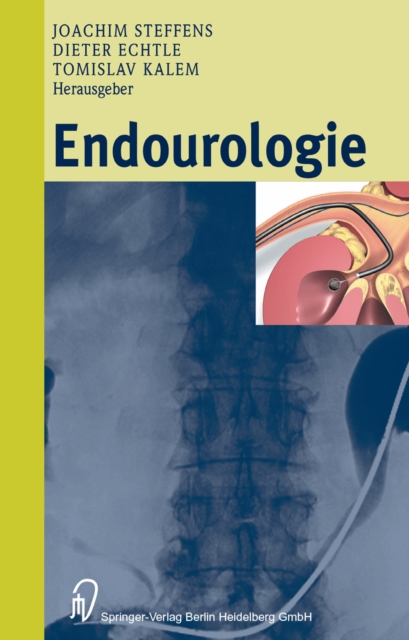 Endourologie, PDF eBook