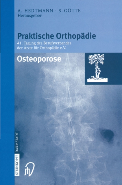 Osteoporose, PDF eBook