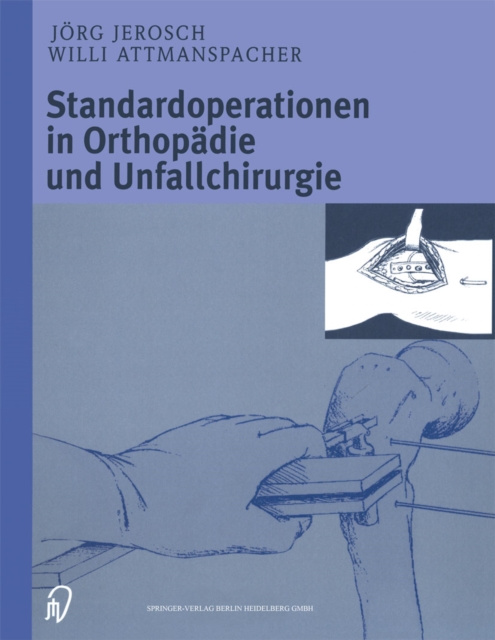 Standardoperationen in Orthopadie und Unfallchirurgie, PDF eBook