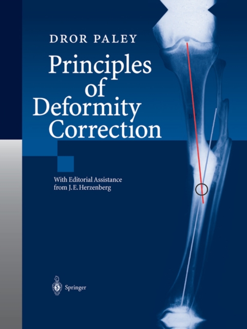 Principles of Deformity Correction, PDF eBook