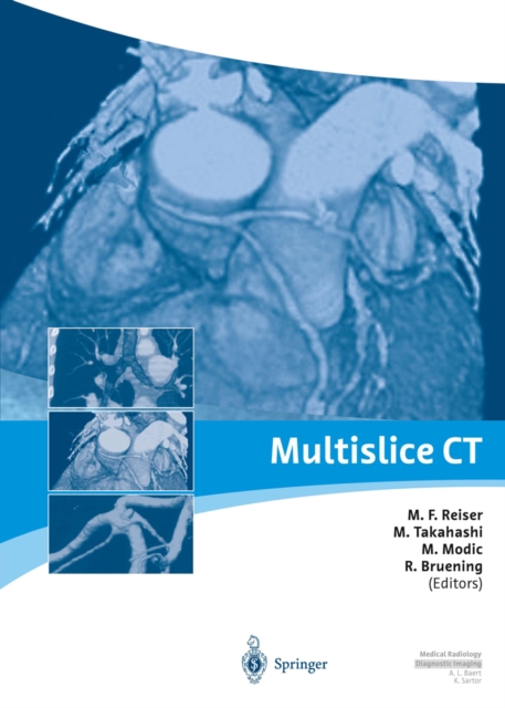 Multislice CT, PDF eBook
