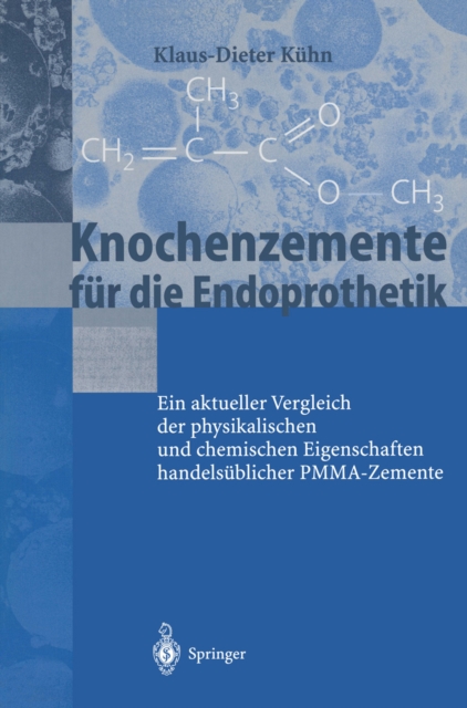 Knochenzemente fur die Endoprothetik : Ein aktueller Vergleich der physikalischen und chemischen Eigenschaften handelsublicher PMMA-Zemente, PDF eBook