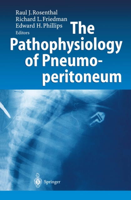 The Pathophysiology of Pneumoperitoneum, PDF eBook