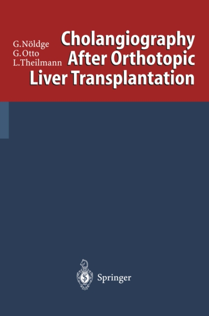 Cholangiography After Orthotopic Liver Transplantation, PDF eBook