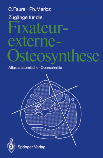 Zugange fur die Fixateur-externe-Osteosynthese : Atlas anatomischer Querschnitte, PDF eBook