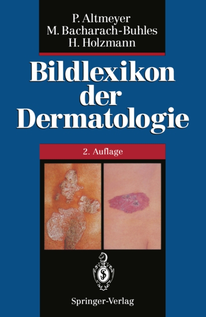 Bildlexikon der Dermatologie, PDF eBook