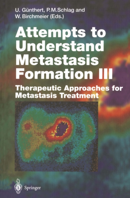 Attempts to Understand Metastasis Formation III : Therapeutic Approaches for Metastasis Treatment, PDF eBook