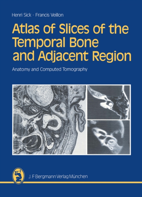 Atlas of Slices of the Temporal Bone and Adjacent Region : Anatomy and Computed Tomography Horizontal, Frontal, Sagittal Sections, PDF eBook