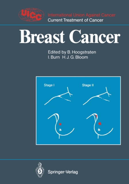 Breast Cancer, PDF eBook