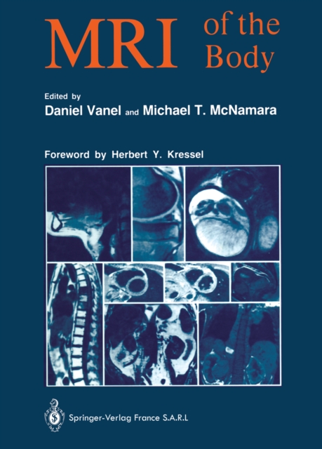 MRI of the Body, PDF eBook