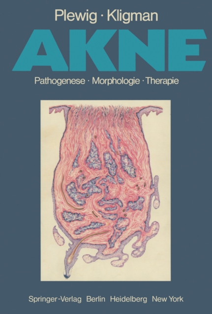 Akne : Pathogenese Morphologie Therapie, PDF eBook