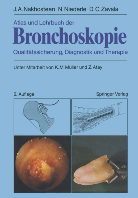 Atlas und Lehrbuch der Bronchoskopie : Qualitatssicherung, Diagnostik und Therapie, PDF eBook