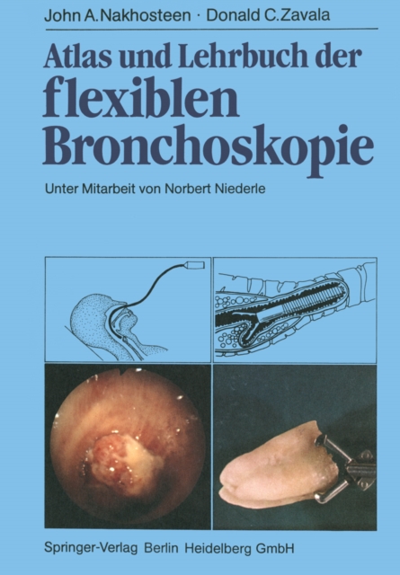 Atlas und Lehrbuch der Bronchoskopie : Qualitatssicherung, Diagnostik und Therapie, PDF eBook
