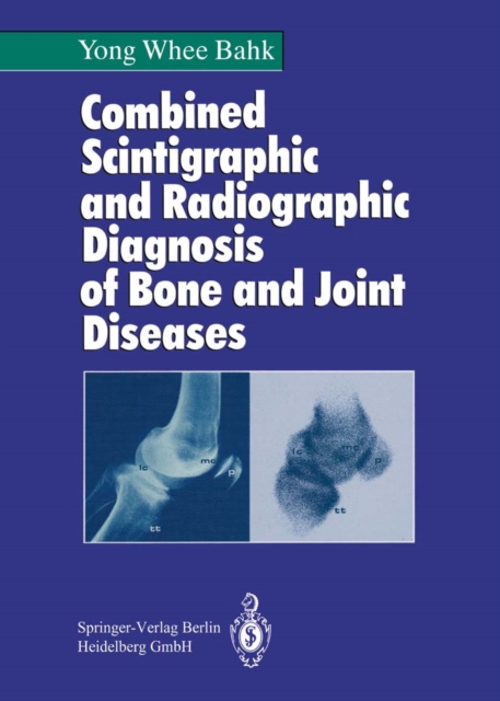 Combined Scintigraphic and Radiographic Diagnosis of Bone and Joint Diseases, PDF eBook