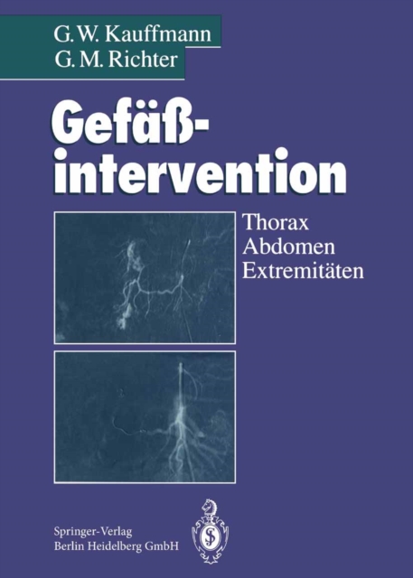 Gefaintervention : Thorax, Abdomen, Extremitaten, PDF eBook