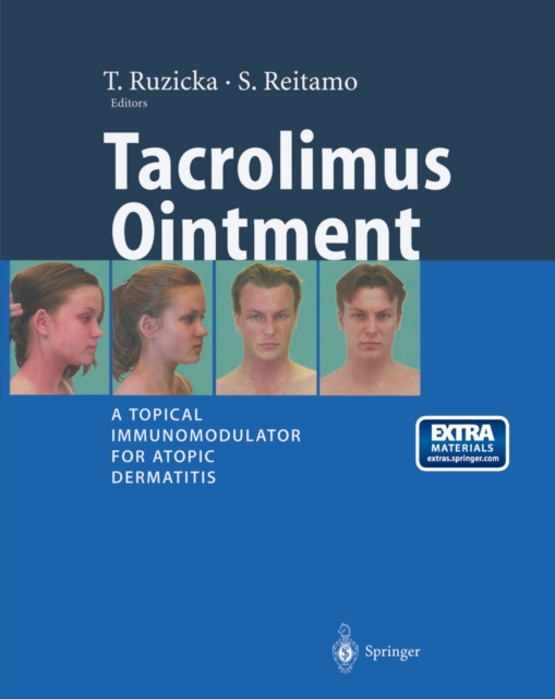 Tacrolimus Ointment : A Topical Immunomodulator for Atopic Dermatitis, PDF eBook