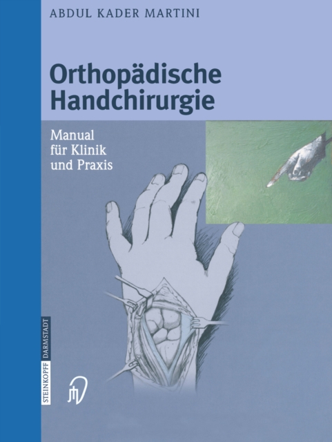 Orthopadische Handchirurgie : Manual fur Klinik und Praxis, PDF eBook