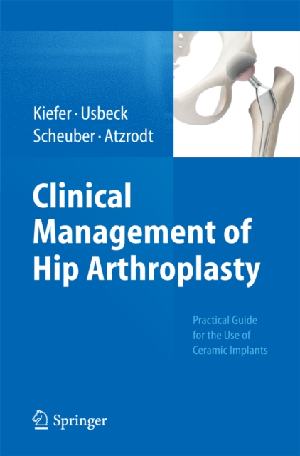 Clinical Management of Hip Arthroplasty : Practical Guide for the Use of Ceramic Implants, PDF eBook