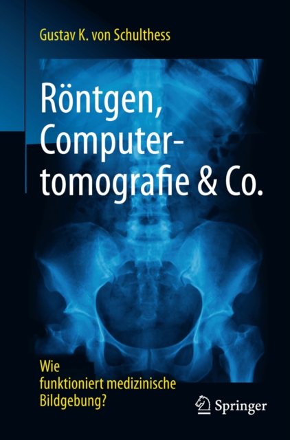 Rontgen, Computertomografie & Co. : Wie funktioniert medizinische Bildgebung?, PDF eBook