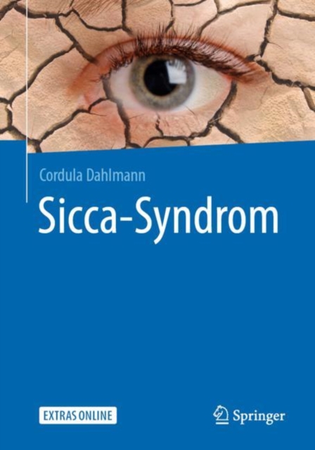 Sicca-Syndrom, EPUB eBook