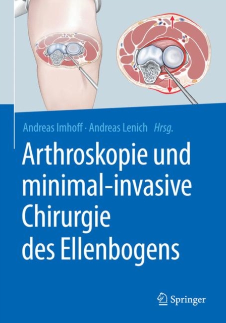 Arthroskopie und minimal-invasive Chirurgie des Ellenbogens, EPUB eBook